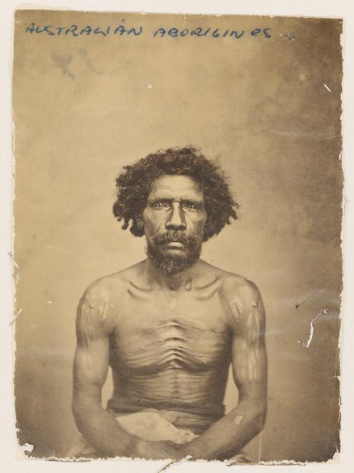 Portrait of a bearded Aboriginal man with his hands on lap displaying his decorative scarring [picture]