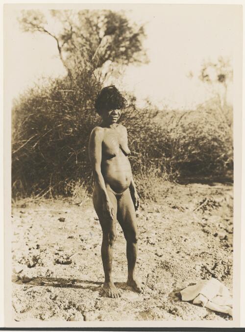 Aboriginal woman with decorative scarring in linear patterns across her chest, Northern Territory, ca. 1895 [picture] / P. Foelsche