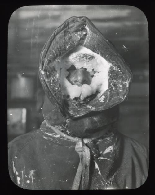 [The icy face of a member of the Australasian Antarctic Expedition team, 1911-1914] [picture] / [Frank Hurley]