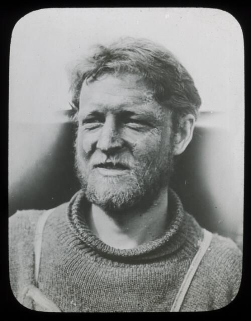 Madigan's frostbitten face, Adelie Land [Australasian Antarctic Expedition, 1911-1914] [picture] / [Frank Hurley]