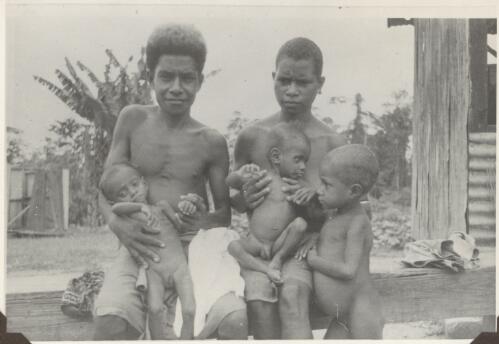 Twin boys suffering from malnutrition from Awala village after eruption, 1952 [picture] / Albert Speer