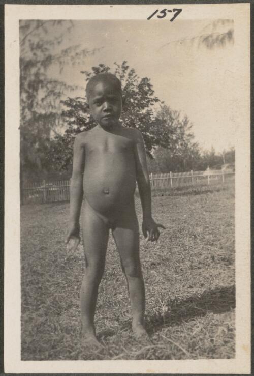 A small Tolai girl, New Britain Island, Papua New Guinea, probably 1916