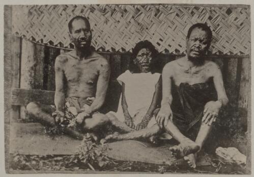 Three Tahitians suffering from leprosy, Tahiti, approximately 1895