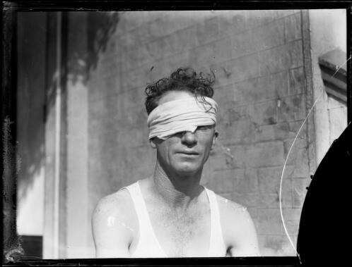 Injured victim Mr Brown with a bandage covering one eye after a pepper throwing assault, New South Wales, 13 May 1932 [picture]