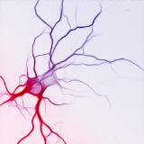 Thumbnail - $25 million, 25 milestones : changing the future of motor neurone disease.