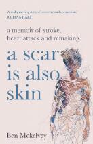 A scar is also skin : a memoir of stroke, heart attack and remaking